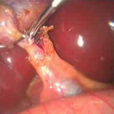Laparoscopic & General Surgery Department Viral Hospital