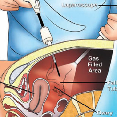 Obstetrics & Gynaecology Viral Hospital