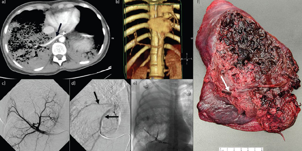 Pulmonology Viral Hospital