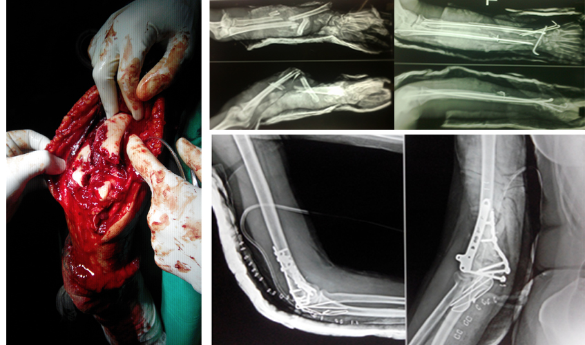 Ortho & Trauma