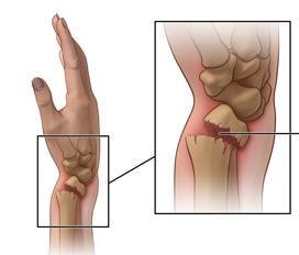 Ortho & Trauma